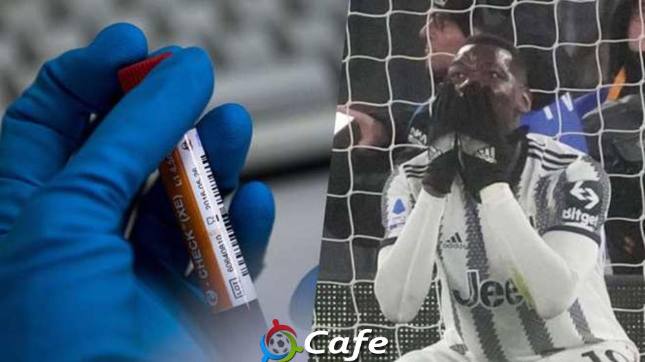 Paul Pogba & cơ hội cuối để tái sinh hướng đến World Cup 2026