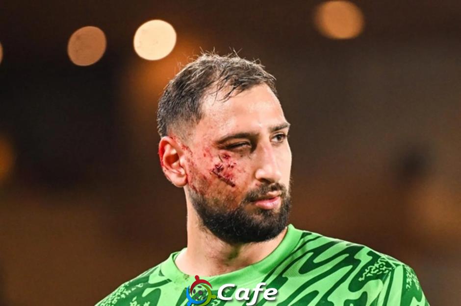 Vết sẹo đã làm biến đổi Donnarumma