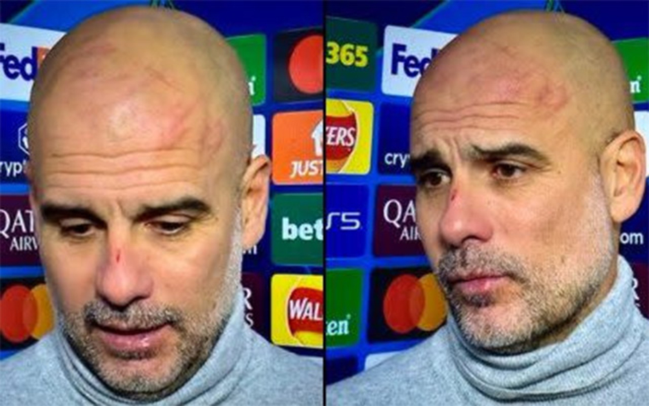 Lộ danh tính cầu thủ khiến HLV Guardiola 'tự hại cơ thể'