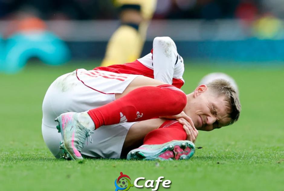 Odegaard và Rice chấn thương, Arsenal lo lắng Odegaard và Rice chấn thương, Arsenal lo lắng